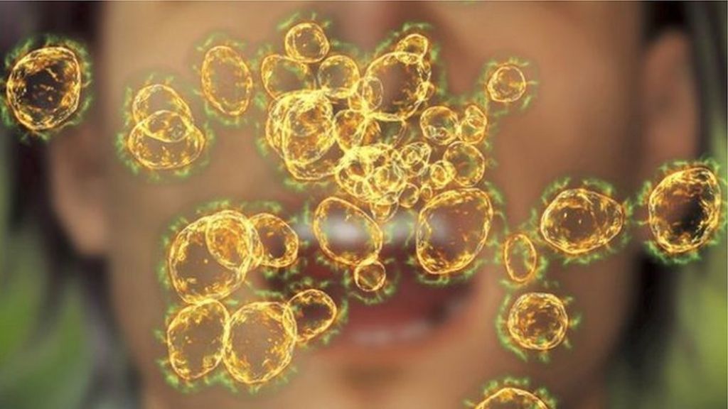 Bird flu case confirmed in Republic of Ireland