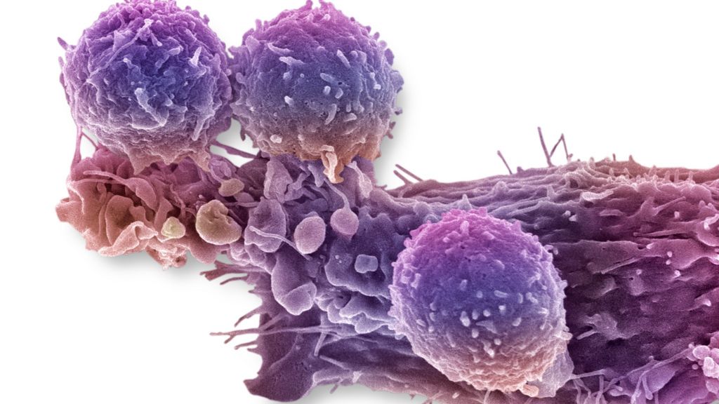 DNA tweak 'boosts' cancer-killing cells