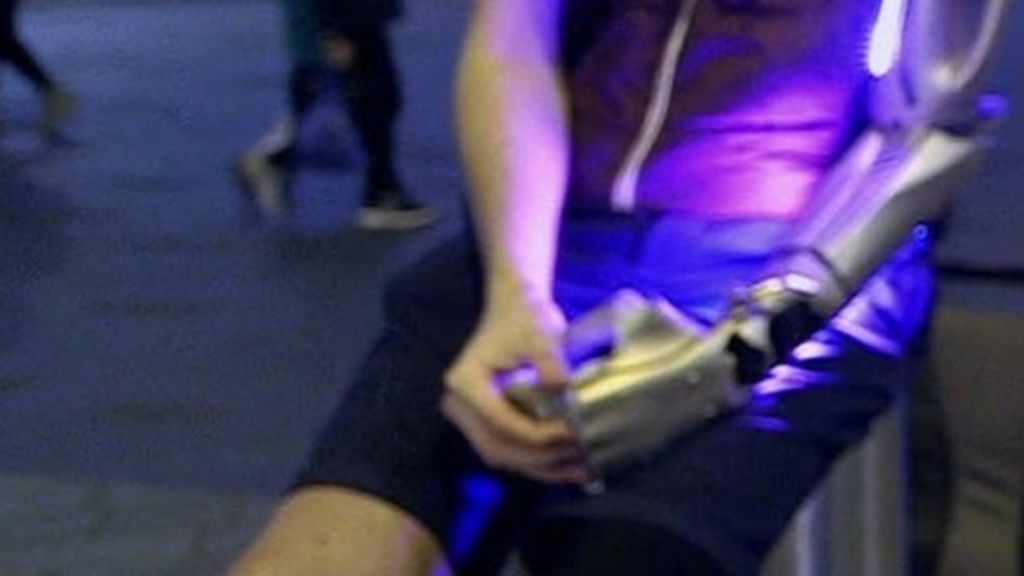 VIDEO: Amputee shows off 'Iron Man arm'