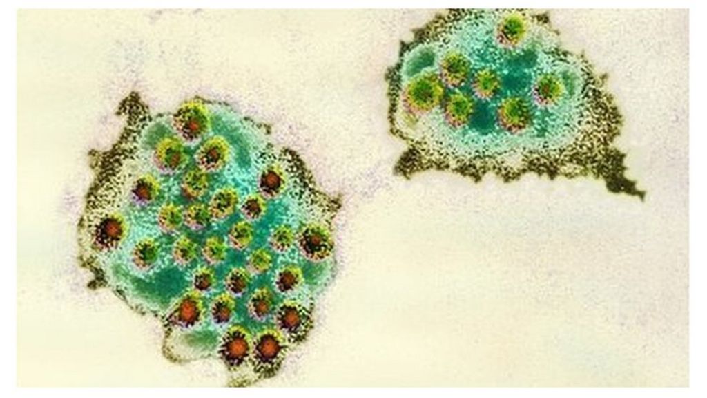 Viral virus
