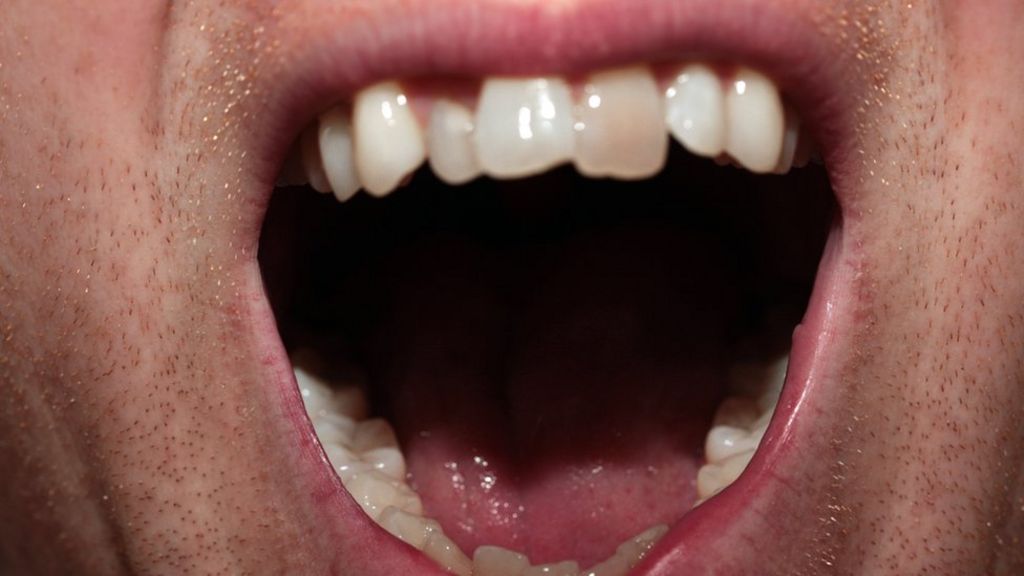 Footballers 'suffer from poor teeth'