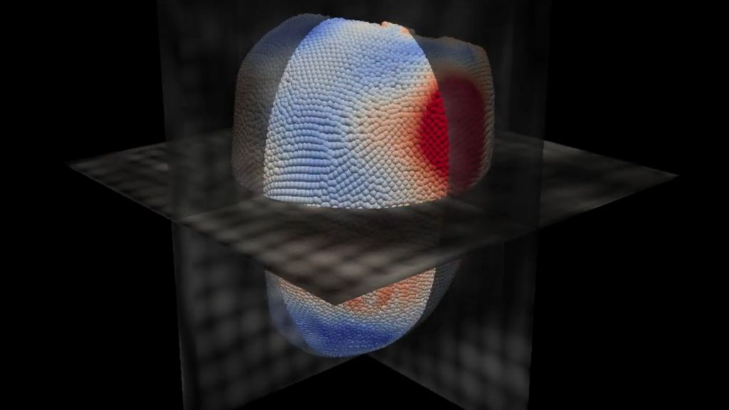 Artificial intelligence predicts when heart will fail