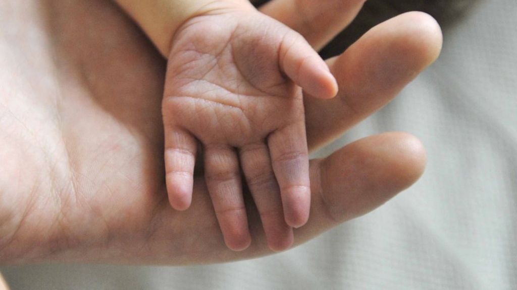 'No smile' baby girl dies after life support row