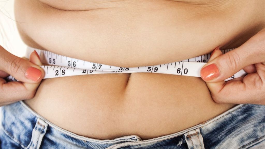 Weight loss surgery 'highest in NE'