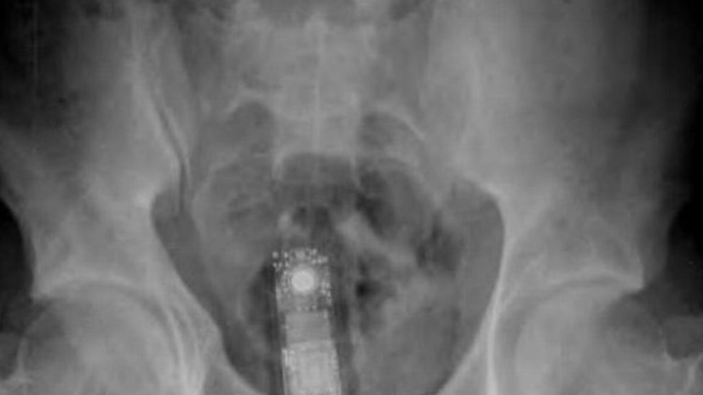 HMP Manchester inmate smuggled phone up backside