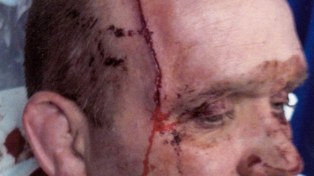 Sgt Mark Wright: Queen's Medal for officer stabbed in head in Lurgan