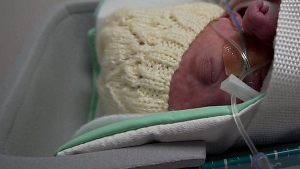 Premature babies benefit from compact MRI scanner