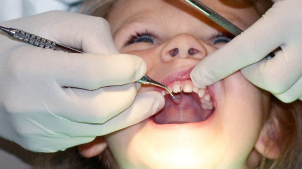 Fluoridated school milk plan approved