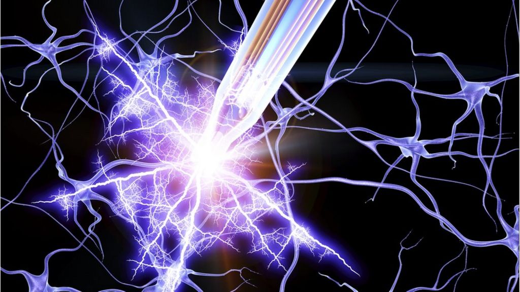 Anorexia Improved by Deep Brain Stimulation