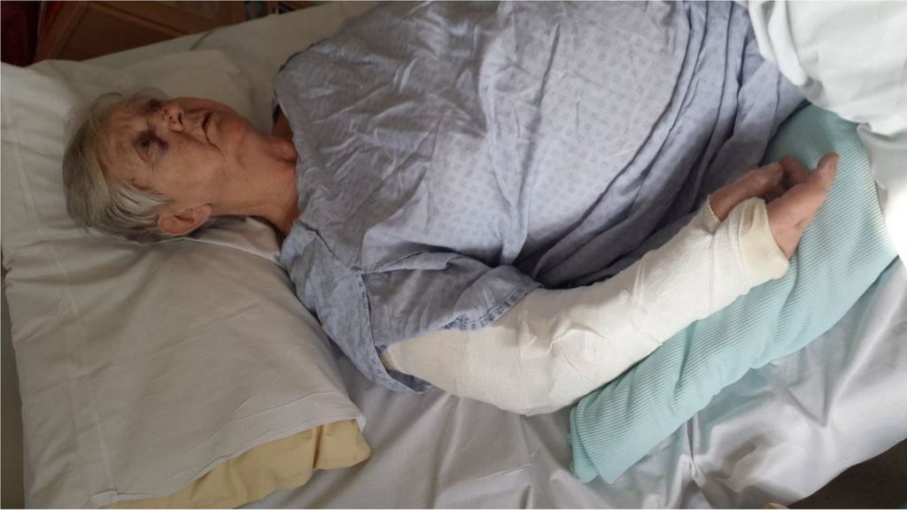 Woman, 79, has arm broken in Coventry bag snatch - BBC News - BBC News