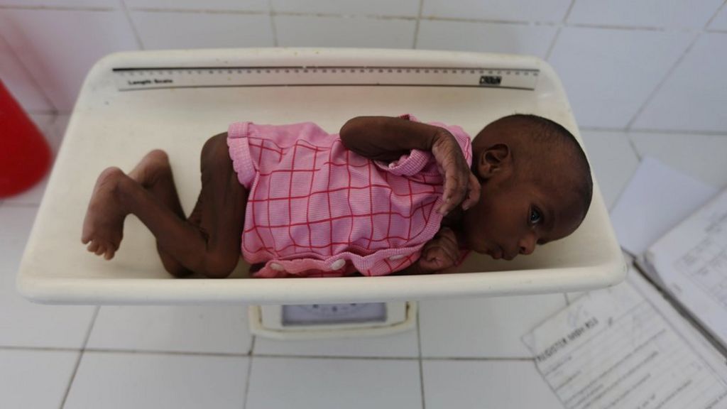 Africa health: Rotavirus vaccine could save 500,000 children a year