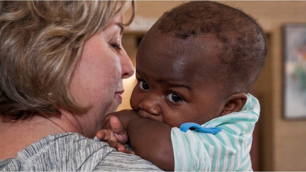 Baby separated from parasitic twin in risky operation