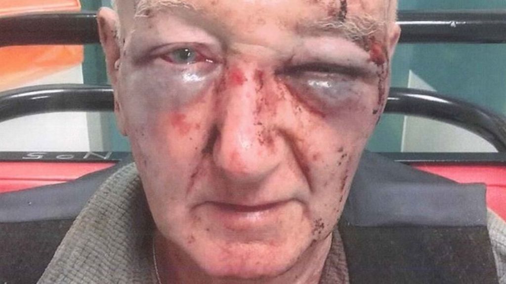 Man held by police over Oldham 'urinating' row attack