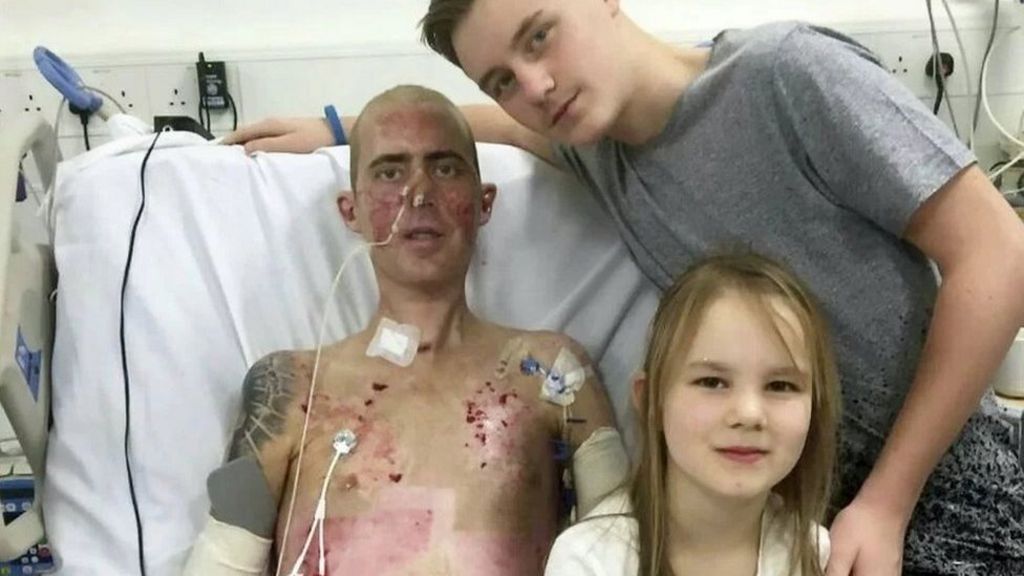 Nottingham man Mark Camamile's bionic arm campaign attracts £30k - BBC News