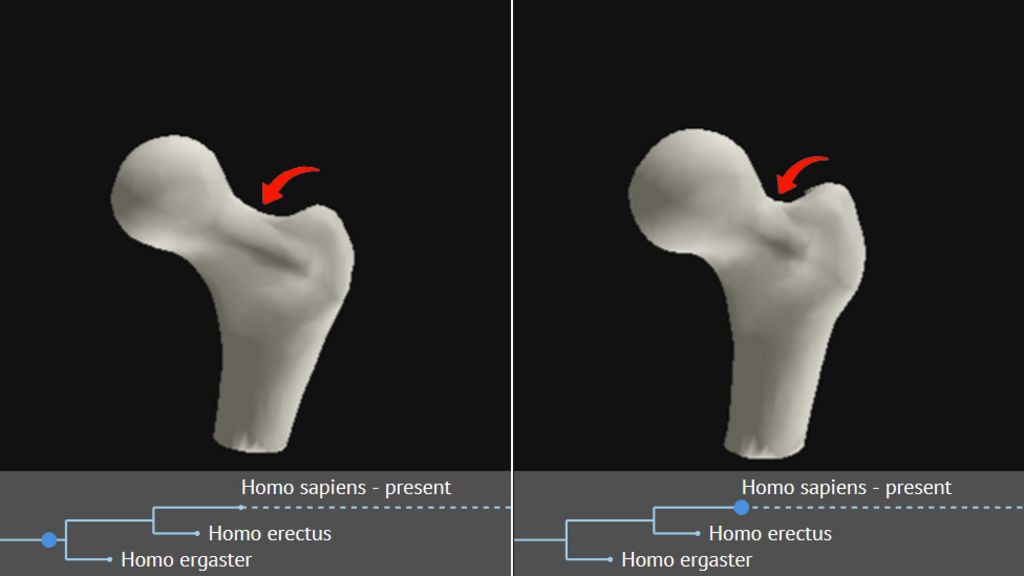 Hip pain may be 'hangover from evolution'