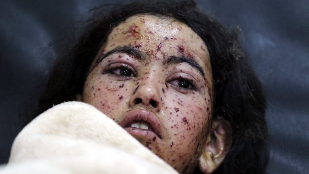 UK to increase aid to £100m to help war-torn Yemen