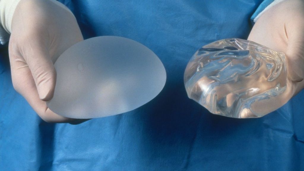 Breast implant register launches 'to safeguard patients'
