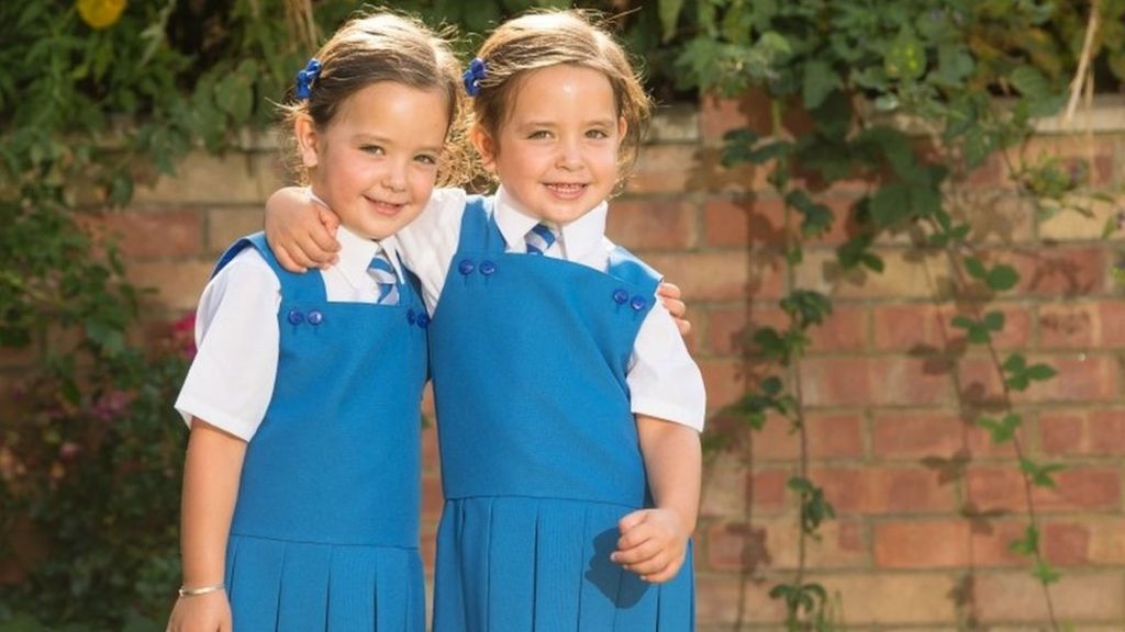 Conjoined twins: 'To see how far they've come is amazing'