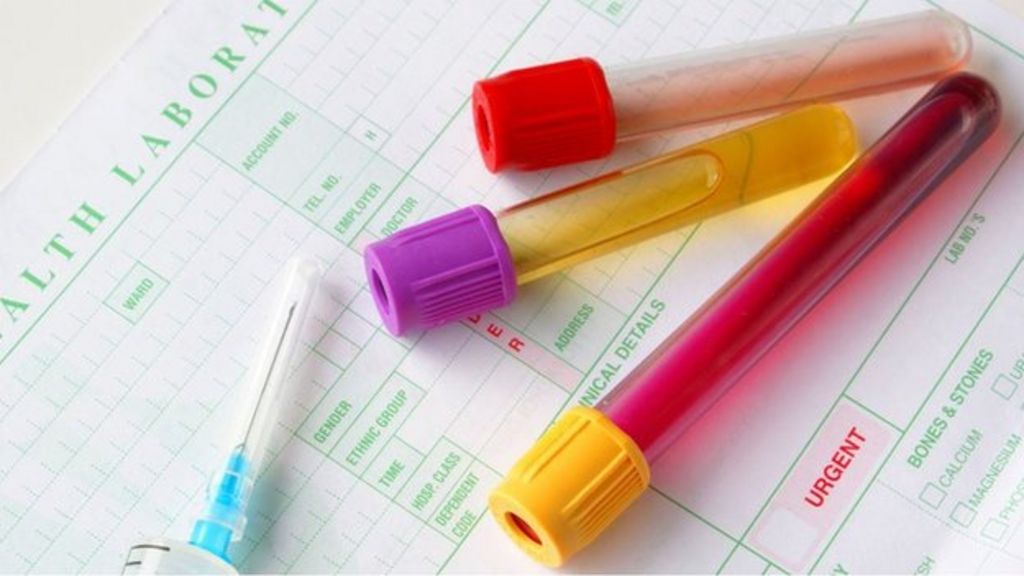 Probe into Randox Manchester 'manipulated' drug tests data