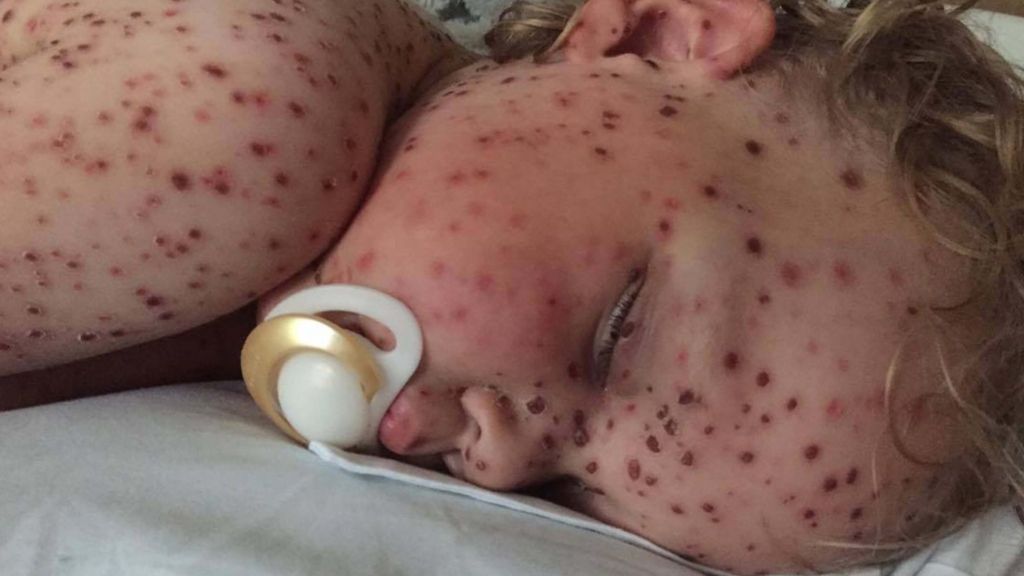 Facebook investigates fake cancer child post