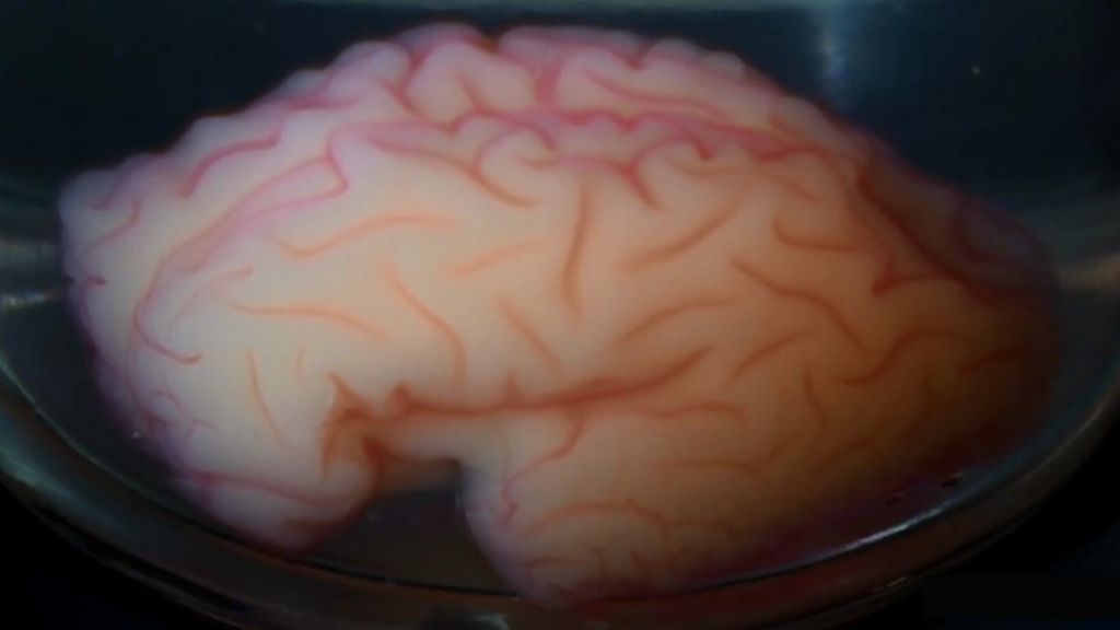 VIDEO: Copying the brain's origami using gel