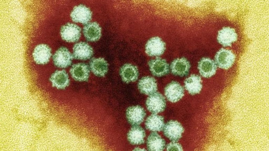 Hospital ward closed by norovirus