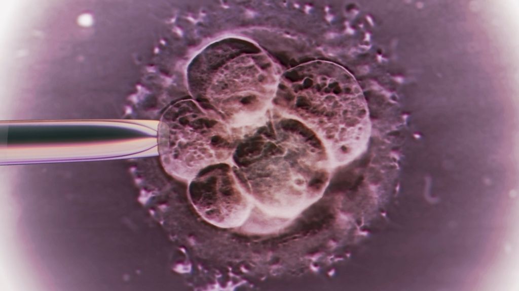 Scientist makes case to edit embryos