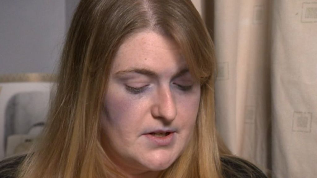 Mansfield mum's mystery bruises baffle doctors