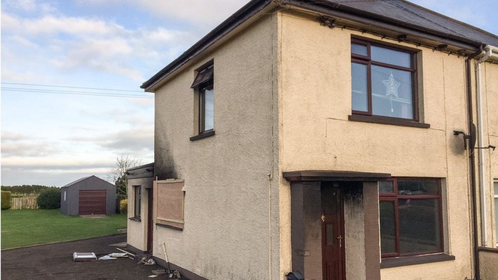 Magilligan: Father describes panic as young son catches fire