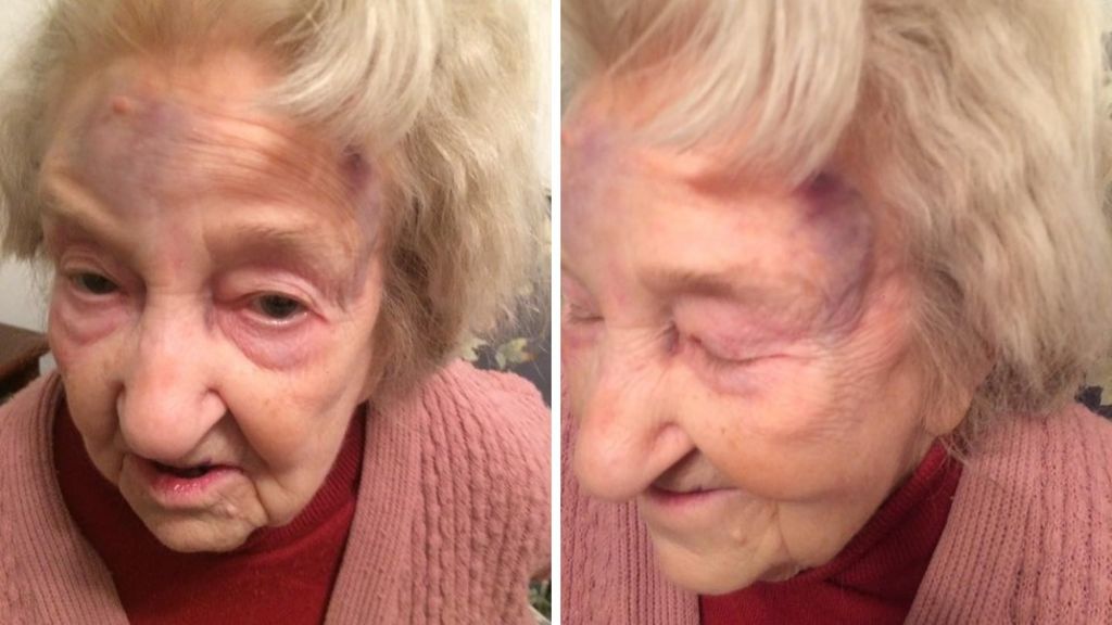 Stretford grandmother Eileen Blane beaten in wedding ring theft