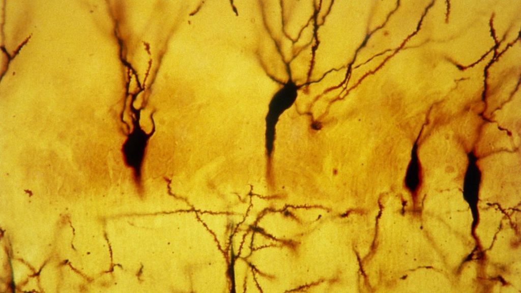 UK trio win 1m euro 'Brain Prize'