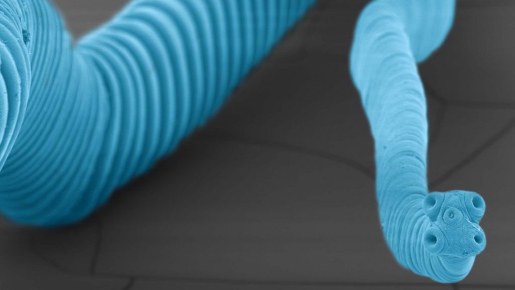 Man died with 'tapeworm tumours'