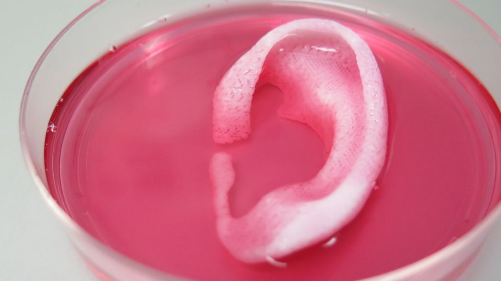Doctors 3D-print 'living' body parts