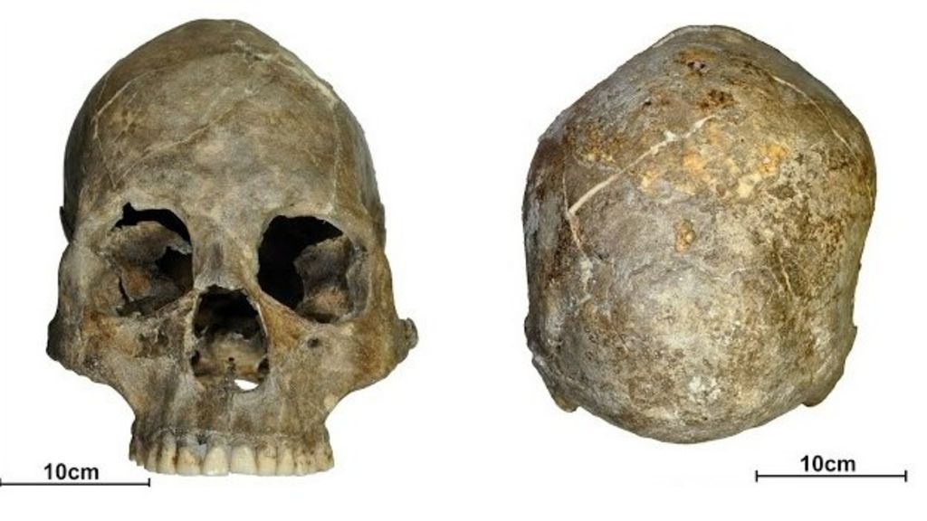 Uni team probes 9,000-year-old skull