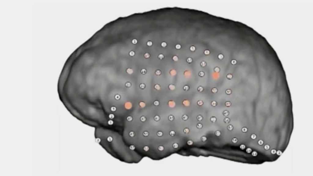 Brain's party noise filter revealed by recordings