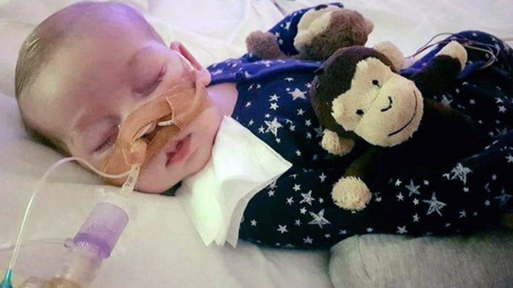 Parents battle doctors to keep baby on life support