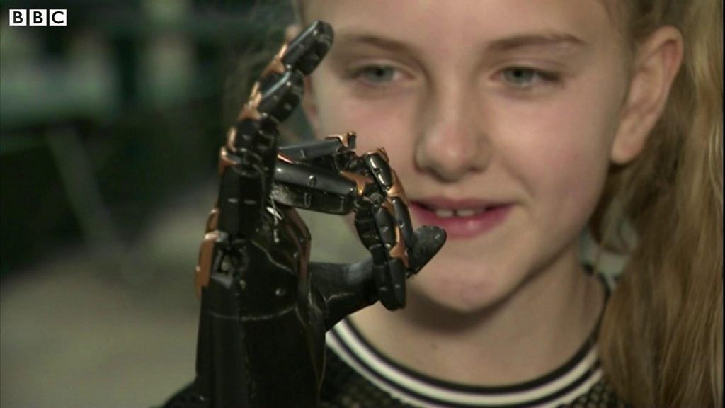 Meningitis Survivor Tilly Lockey Helps To Pioneer Bionic Limbs Bbc News 0754