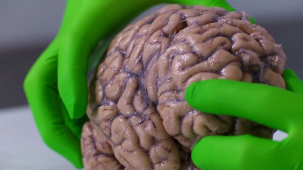 VIDEO: Why the brain is a marvel of evolution