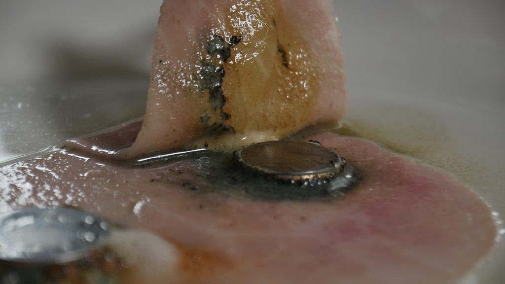 See what a button battery can do to a child's throat