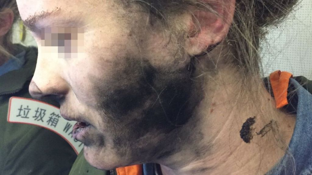Mid-flight slumber cut short by exploding headphones