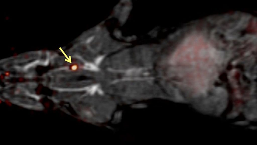 Probe pinpoints blood clot locations
