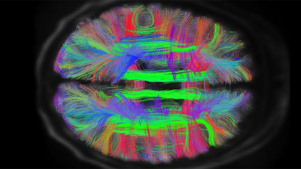 Scans reveal intricate brain wiring BBC News