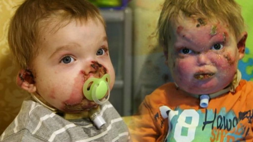 &#39;Butterfly&#39; boys Cody and Harry Churchill funeral held - BBC News - _66642639_jex_9340_de52