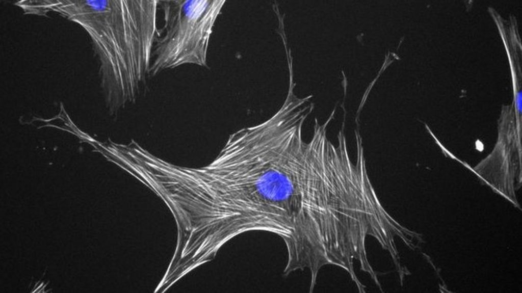 stem-cells-nanokicked-to-grow-new-bone-bbc-news