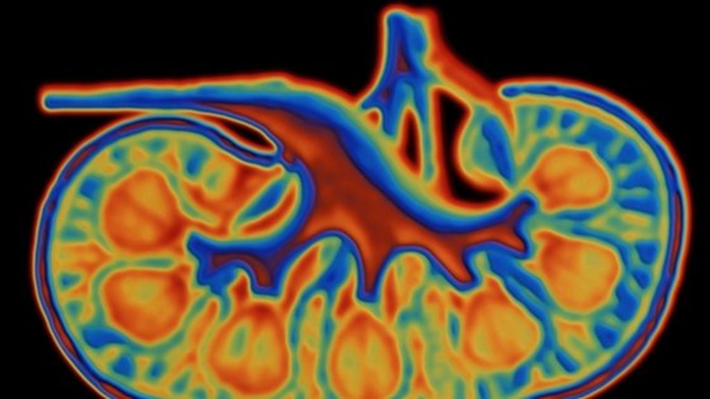 Artificial kidney transplants 'in five years' BBC News