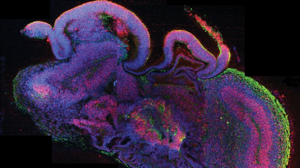 Miniature human Brain Grown In Lab BBC News