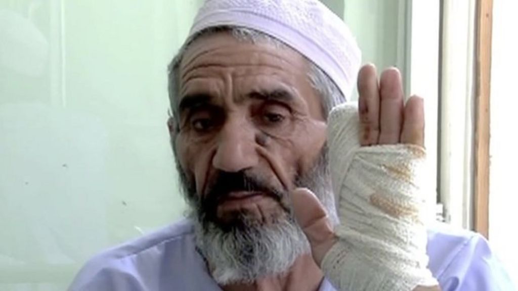 Afghan Election Taliban Chopped My Finger Off Bbc News