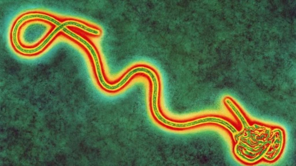 Why Ebola Is So Dangerous Bbc News