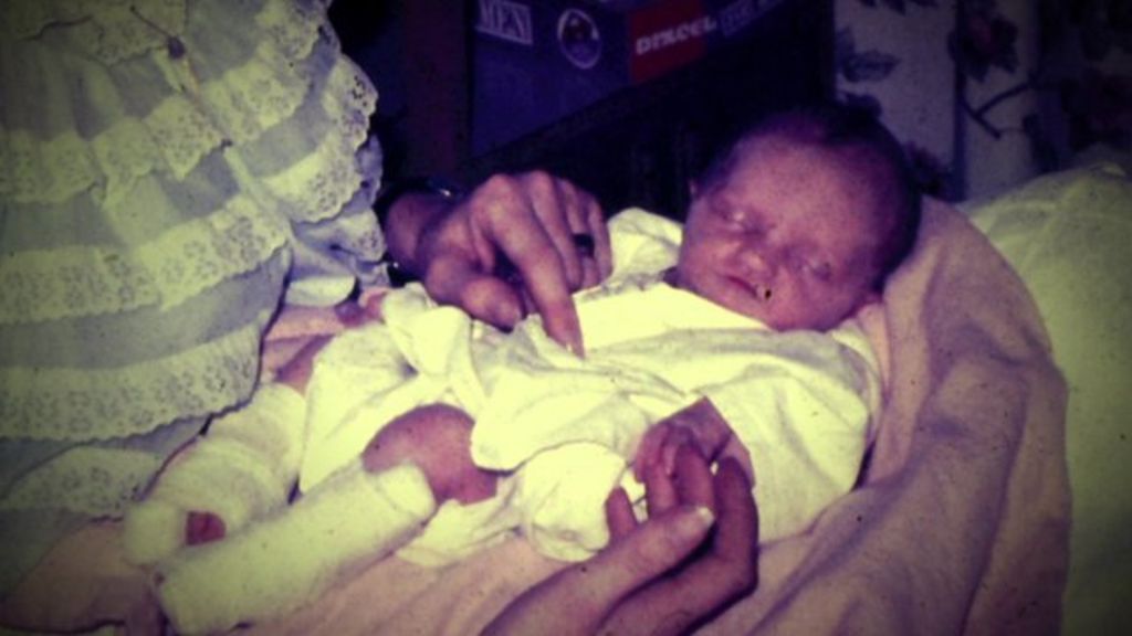 Pregnancy drug Primodos were medical records destroyed? BBC News