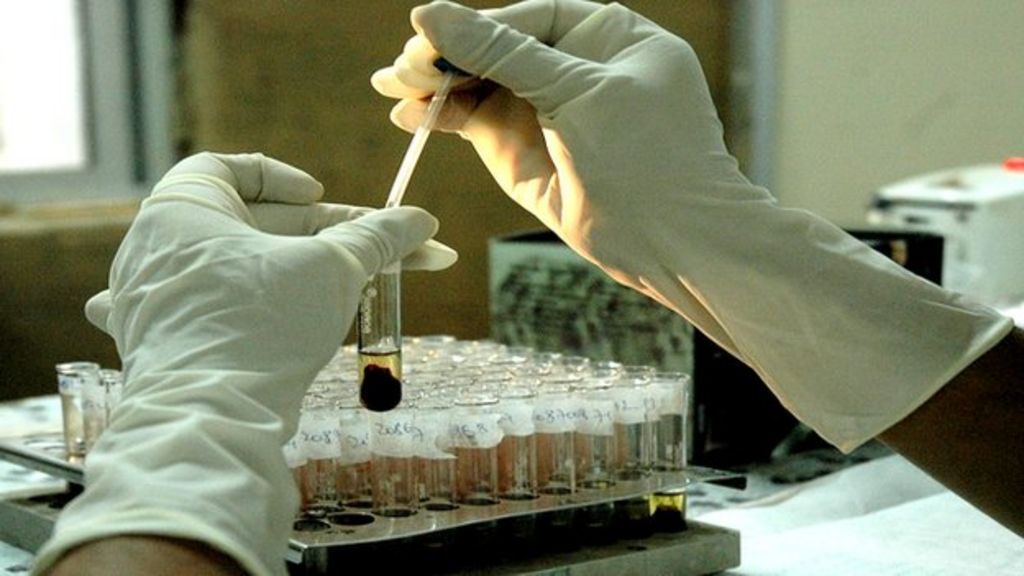 HIV myths persist in Northern Ireland says charity